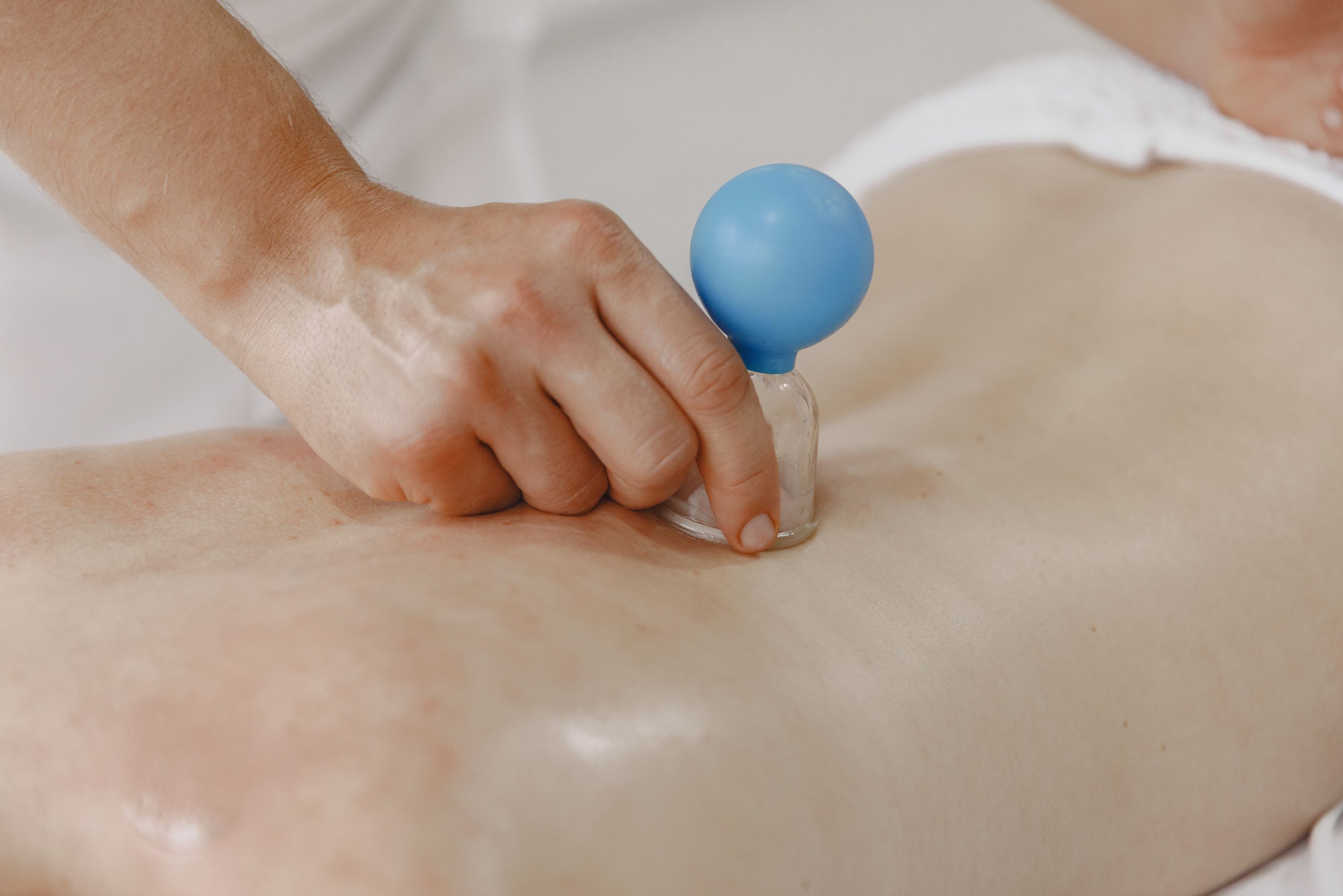 Massage op locatie Detailed close-up of cupping therapy on adult back in a wellness setting.